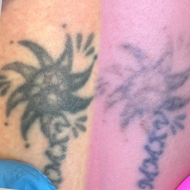 permanento salinimas